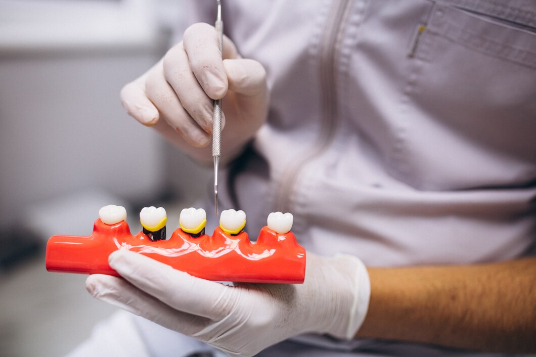 Understanding the Benefits and Differences Between Composite and Amalgam Dental Fillings