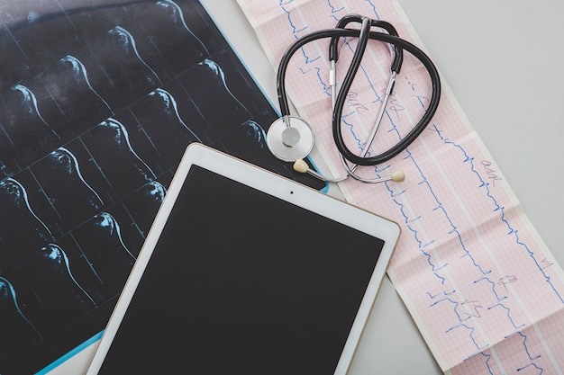 Enhancing Patient Care with Portable EKG Technology